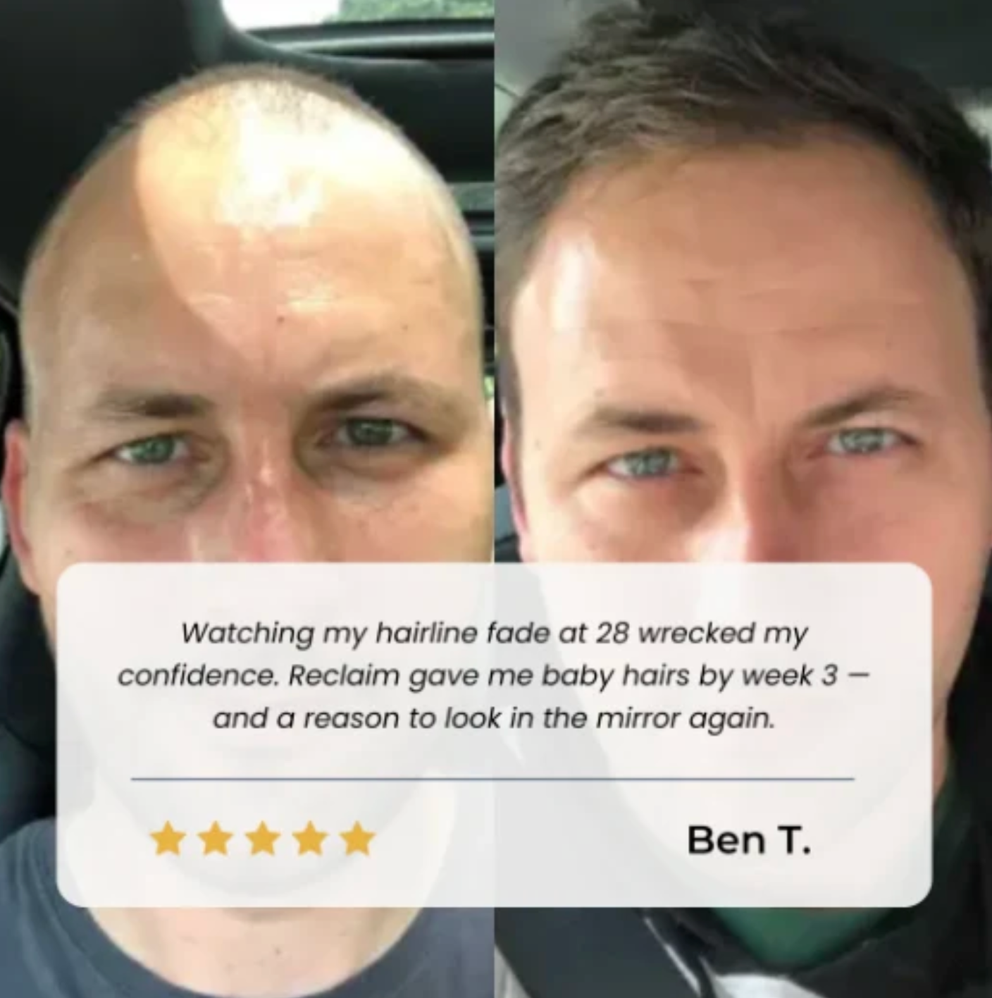 Advanced Hair Growth Roll-on Serum