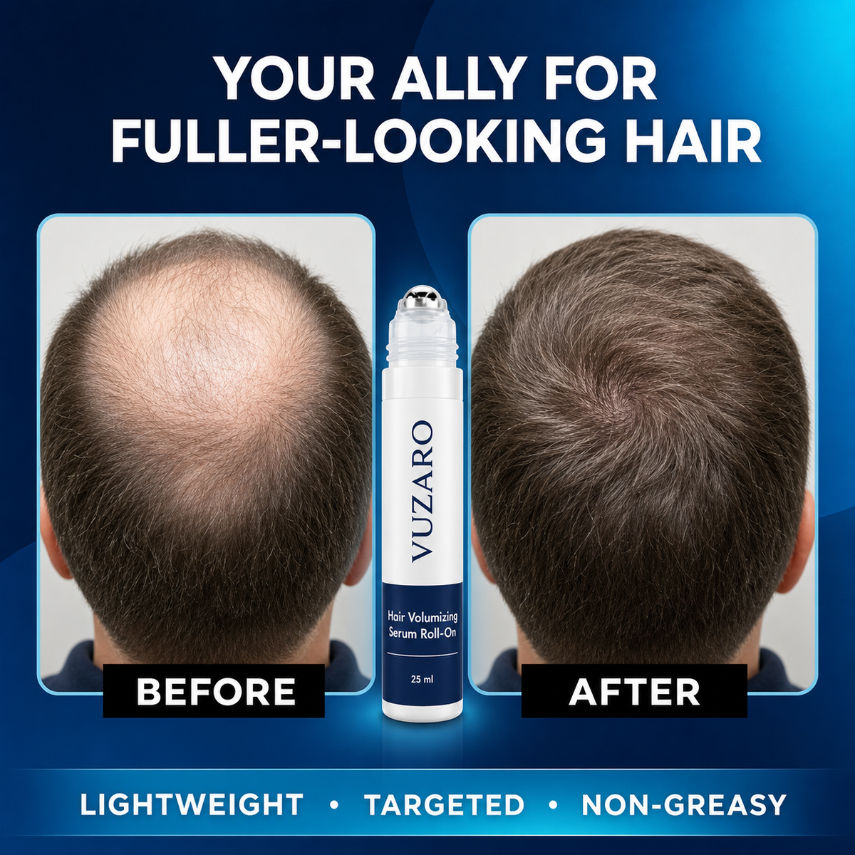 Advanced Hair Growth Roll-on Serum